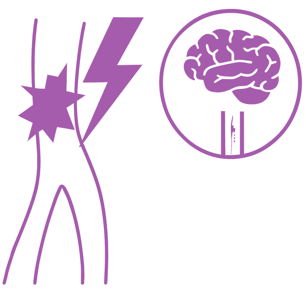Subarachnoid Hemorrhage